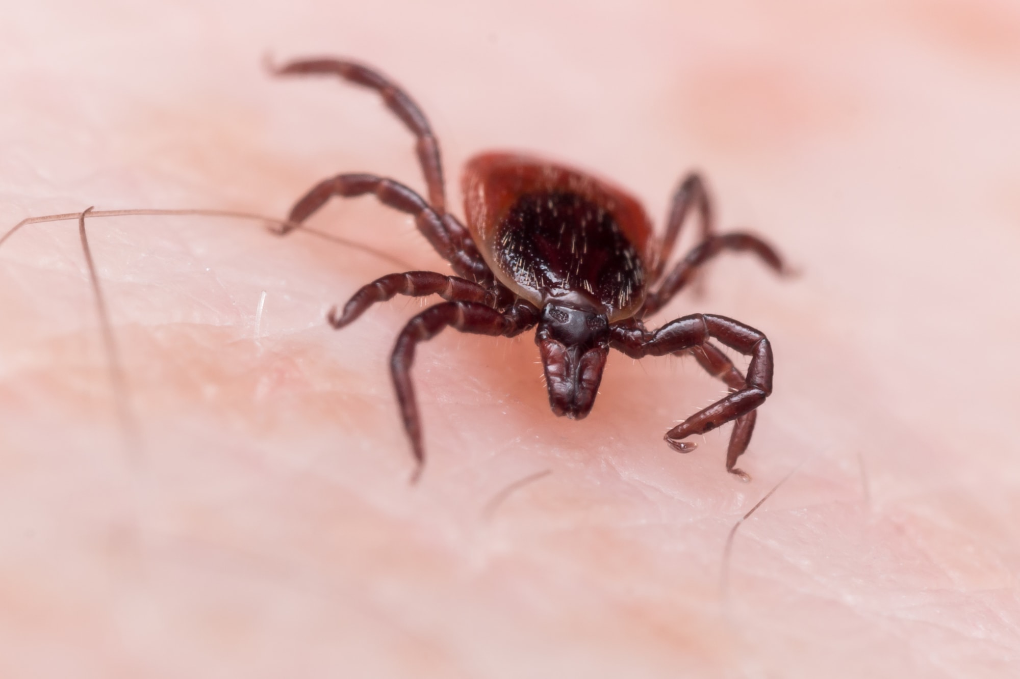deer-tick-on-skin