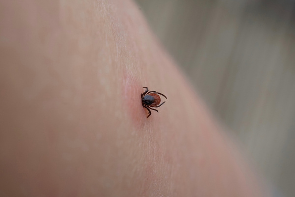 when a tick bites